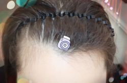 -大麦微针植发全国连锁