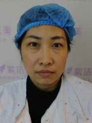 体验前-紫洁俪方（北京）医疗美容