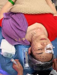 体验前-深圳美莱医疗美容医院