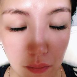 点击看大图 -郡艺医疗美容·微整·眼鼻吸脂