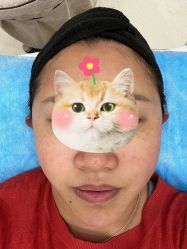 体验前-幼泡泡连锁美容医疗