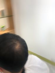 -发饰美男士增发补发假发定制店