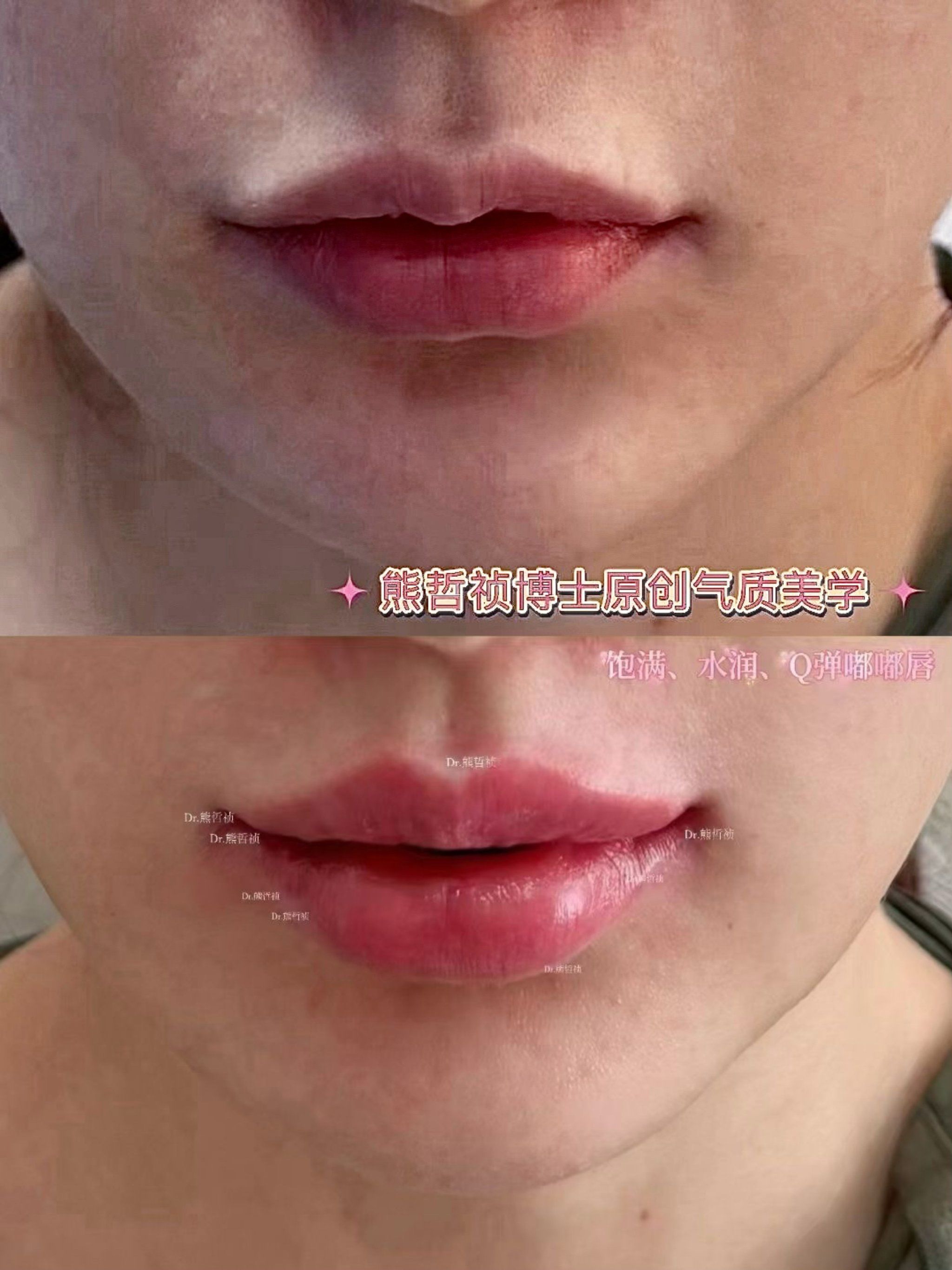 花小钱轻松get嘟嘟唇👄