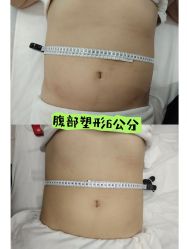 -Lily纤美·科技减脂中心