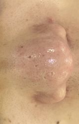 -SKIN79皮肤管理中心