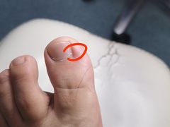 -新甲连锁灰指甲·甲沟炎·鸡眼(黑龙江路店)