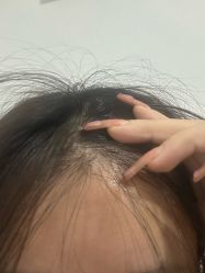 体验后-安徽合肥韩美整形外科医院