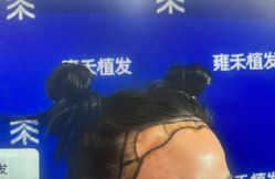 -雍禾植发全国连锁