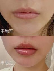 -上海漾颜医疗美容