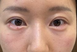 体验后-广州美莱医疗美容医院