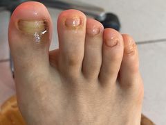 -新甲连锁灰指甲·甲沟炎·鸡眼(黑龙江路店)