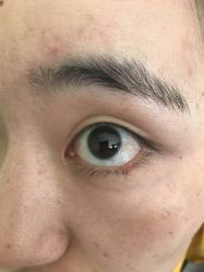 -痣清宫祛斑祛痣连锁店