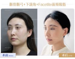 -圣嘉新医疗美容医院