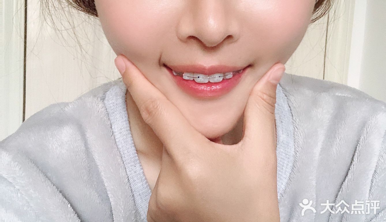 [礼花][礼花]撒花庆祝~！！小美女今天戴上牙套啦
