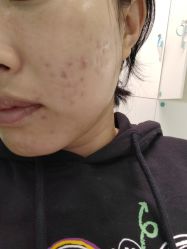 体验后-颜悦医疗美容