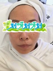 -慕颜医疗美容·皮肤微整 抗衰