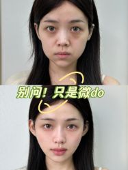-宁波美莱整形美容