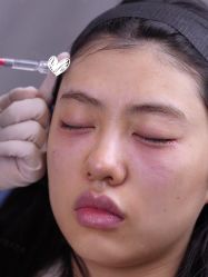 -Yestar重庆艺星医疗美容医院