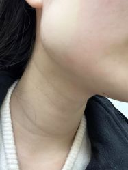 -成都西区医院整形美容