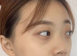 点击看大图 -天津健丽·去眼袋医疗美容机构