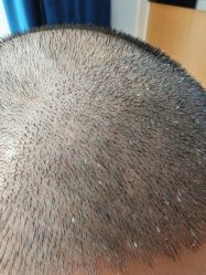 -雍禾植发全国连锁