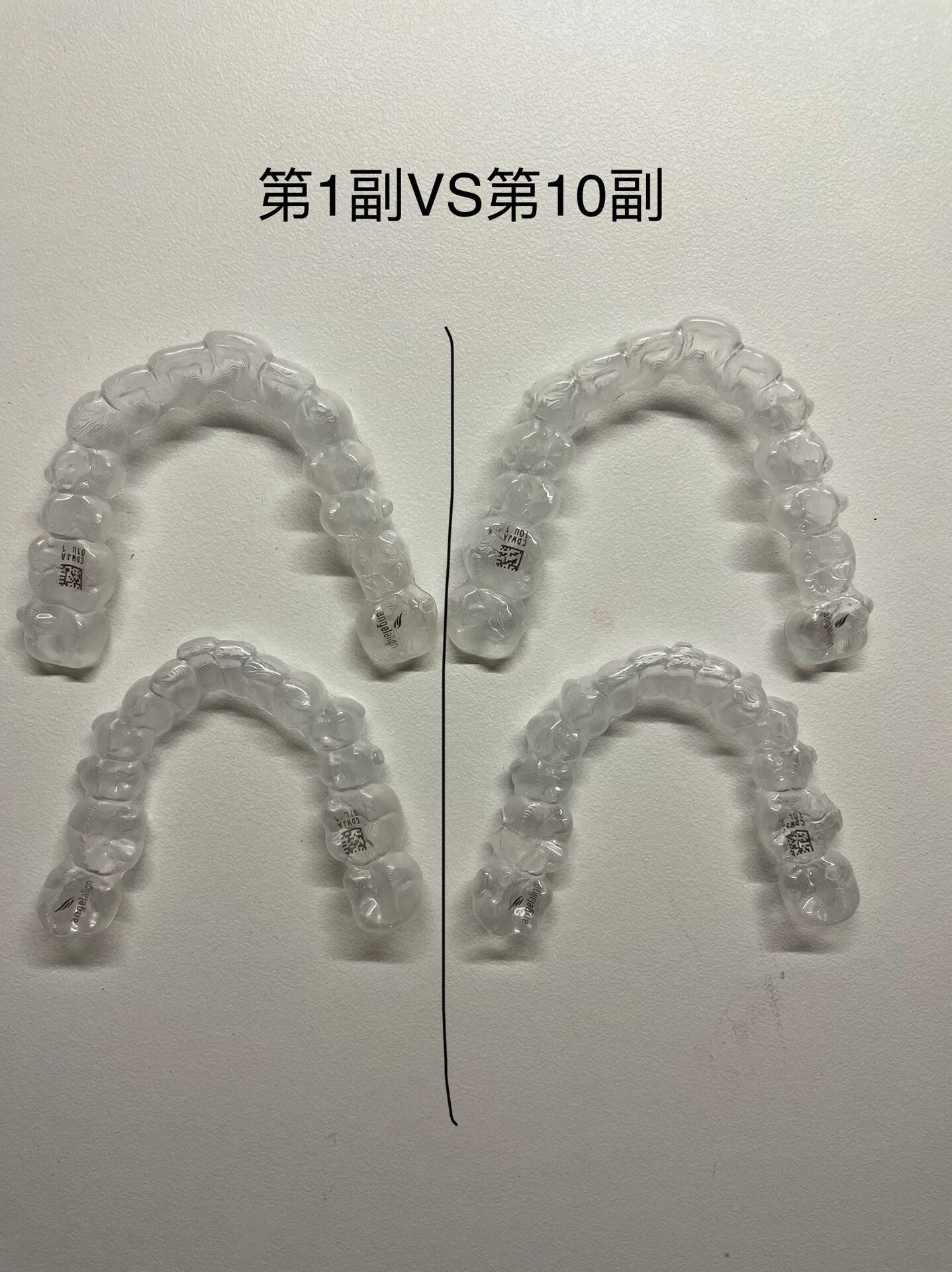 隐形牙套十副效果对比图