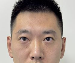 -天津健丽·去眼袋医疗美容机构