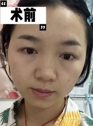 -素美医疗美容·西南眼鼻整形·修复基地