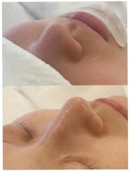 -AiCure 埃可儿·韩国医学皮肤管理