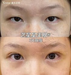 -Yestar重庆艺星医疗美容医院