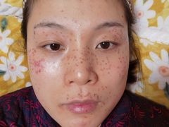 -杭州市第三人民医院