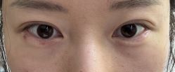 体验后-广州美莱医疗美容医院
