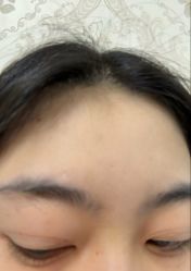 -长沙雅美医疗美容医院