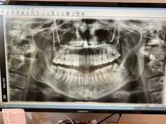 -赫尔森口腔·牙齿种植修复