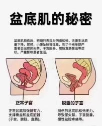 -莫纳瑜伽·普拉提