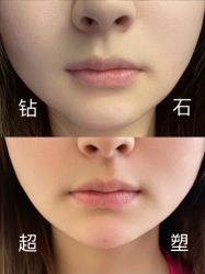 -至简医疗美容·医生集团
