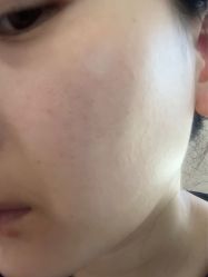 体验后-上海玫瑰医疗美容医院