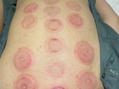 -阮氏中医推拿·颈肩腰腿(世纪公园店)