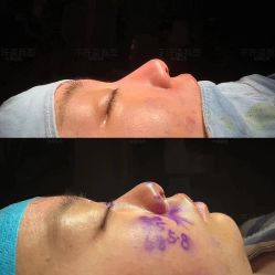 体验后-成都西区医院整形美容