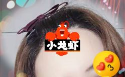 -大麦微针植发全国连锁