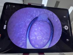 -凡碧诗毛孔清洁收细