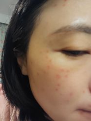 -针美汇欧邦医疗美容