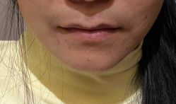 体验前-南京医科大学友谊整形外科医院