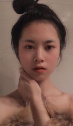 点击看大图 体验后-广东韩妃整形外科医院