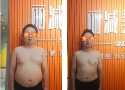 -丽减美瘦吧·减肥瘦身