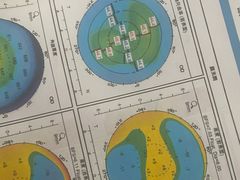 -美尔目眼科医院·近视手术·儿童近视(通州店)