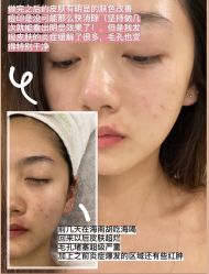 -FUMEIHUI·科技美肤·美体SPA