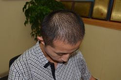 -大麦微针植发丨全国连锁