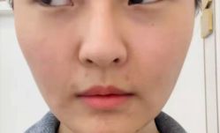 -洁铭新加坡医美