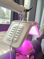 -碧莲盛·不剃发植发